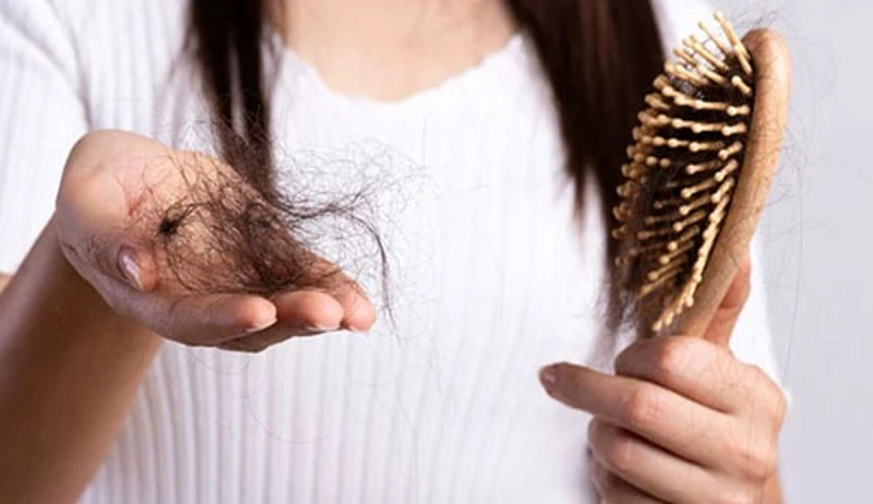 دلایل احتمالی برای درمان ریزش مو در نوجوانان