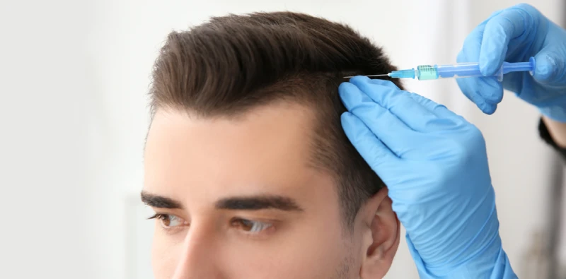 نکات مهم درباره پوشاندن و درمان کم پشتی موی سر مردان