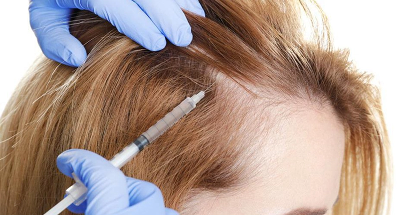 روش های موثر در درمان ریزش مو