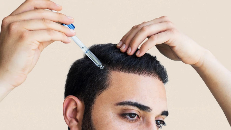 راه های درمان ریزش مو چیست؟