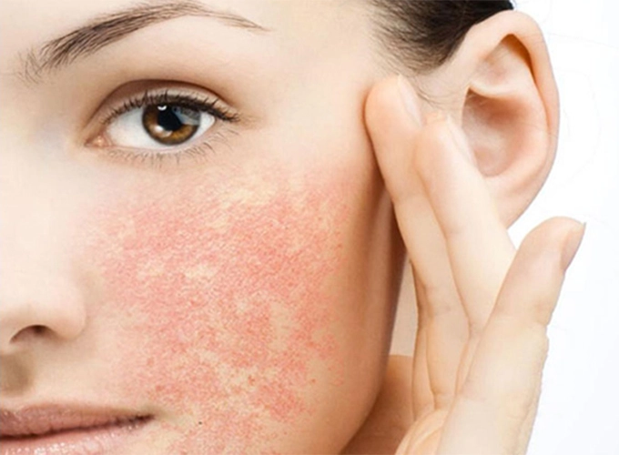 انواع ژل شستشوی صورت برای پوست خشک و حساس