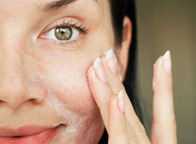 پوست حساس دارای چه ویژگی هایی است؟