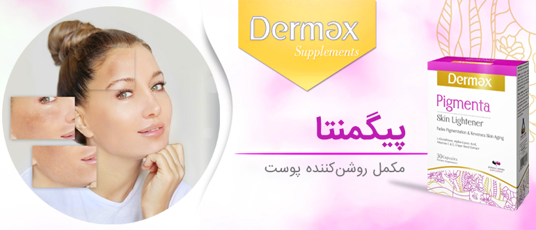 پیگمنتا