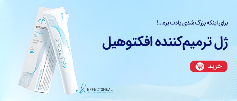اسلایدر ژل ترمیم کننده افکتوهیل